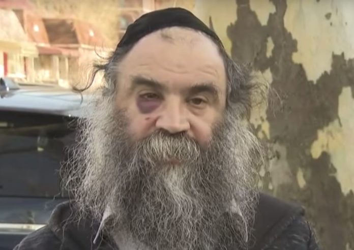 Jewish Man Attacked In Crown Heights While Walking Home From Shabbat Services