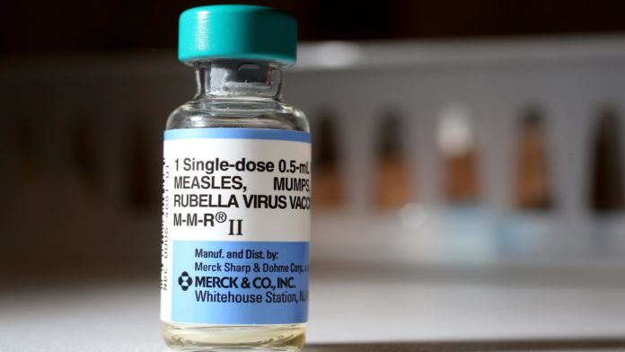 measles