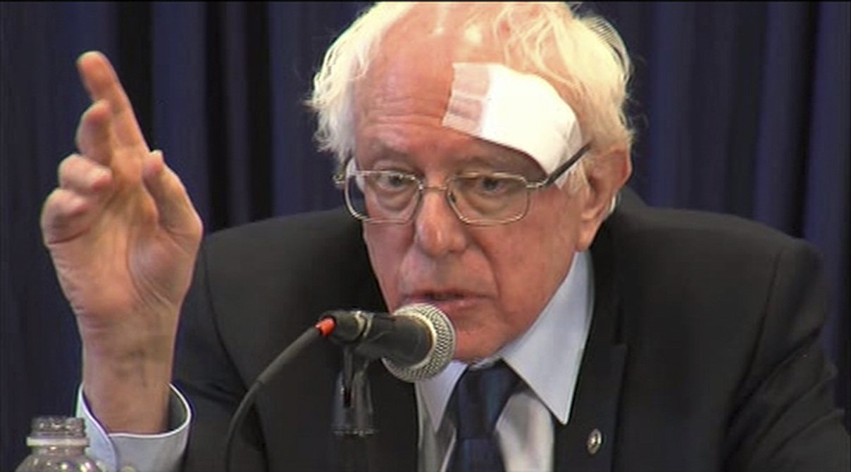 OUCH! Bernie Sanders Gets Stitches After RunIn With Glass Shower Door