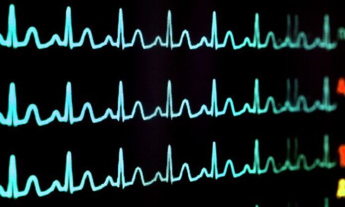 life-support-machine-lines