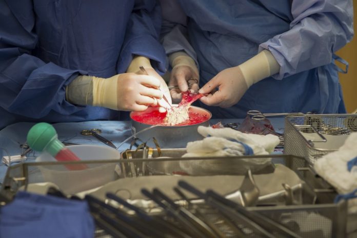 kidney-transplant