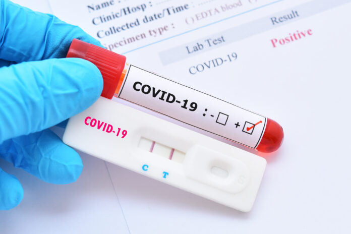 covid-19-testing-shutterstock