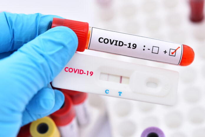 COVID-19.Article.June2.MK-2020-105-57.1200x800